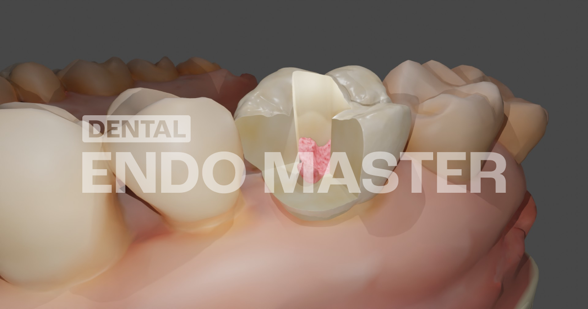 About Dental EndoMaster